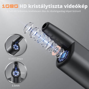 Elektromos fülzsír eltávolító kamerával és LED világítással – 4 nyomásfokozatú fültisztító készlet - BShopy