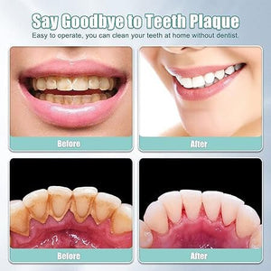 HassoKon Ultrahangos Fogkő Lepedék Eltávolító Készlet - Fekete - BShopy