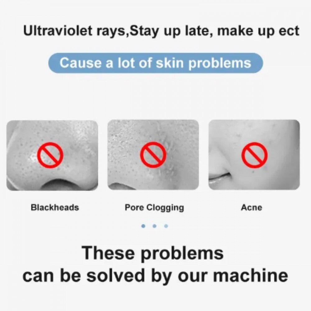 AmazeFan Ultrahangos Arctisztító Készülék - Mélytisztító Bőrápoló Spatula (Fehér) - BShopyarctisztító géparctisztító készülékbeauty eszköz6035 - CPJ - 100 - WHITE_7