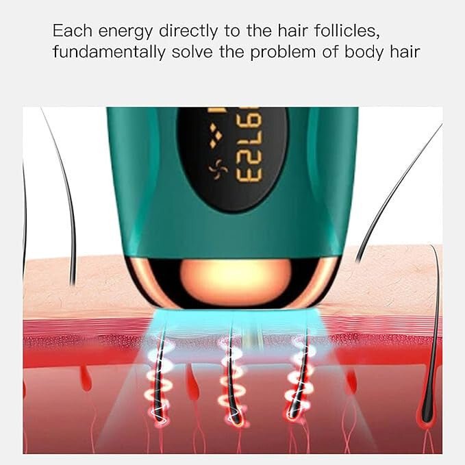 IPL Otthoni Szőrtelenítő Eszköz Smaragdzöld és Bronz Színben - Hatékony és Kényelmes - BShopy